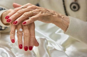 Chirurgia Estetica - Ringiovanimento Mani