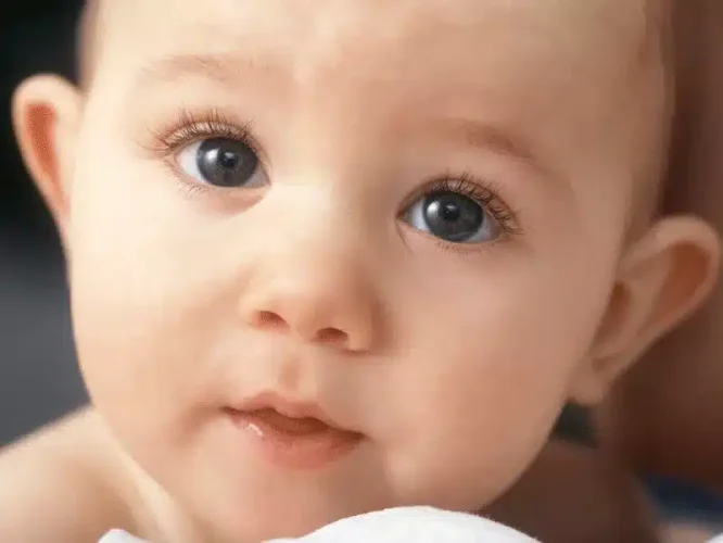 chirurgia cranio-facciale pediatrica - Dott. Rufolo - Chirurgo Plastico