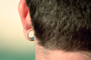 Chirurgia Plastica e schisi lobo auricolare